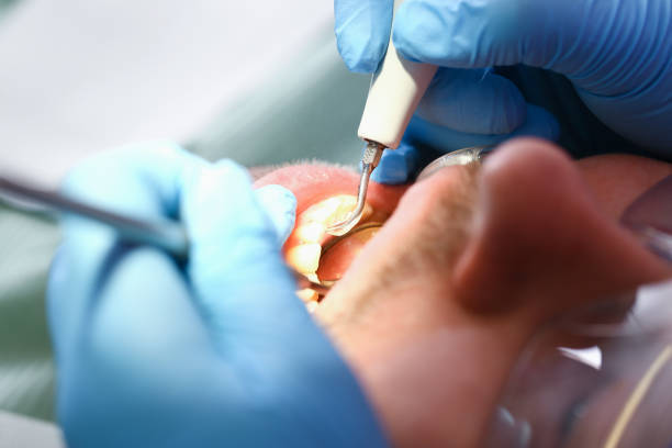 Best Emergency Root Canal Treatment in Lambert, MS