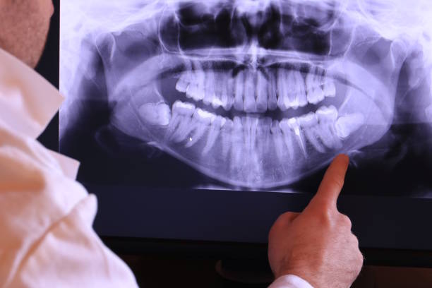 Best Walk-In Emergency Dentist in Lambert, MS