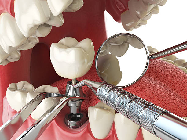 Best After-Hours Emergency Dentist in Lambert, MS